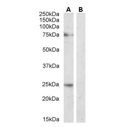 Western Blot - Anti-DLL1 Antibody (A84659)