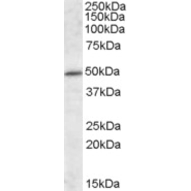 Western Blot - Anti-HIPPI/IFT57 Antibody (A84663) - Antibodies.com