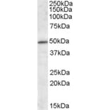 Western Blot - Anti-HIPPI/IFT57 Antibody (A84663) - Antibodies.com
