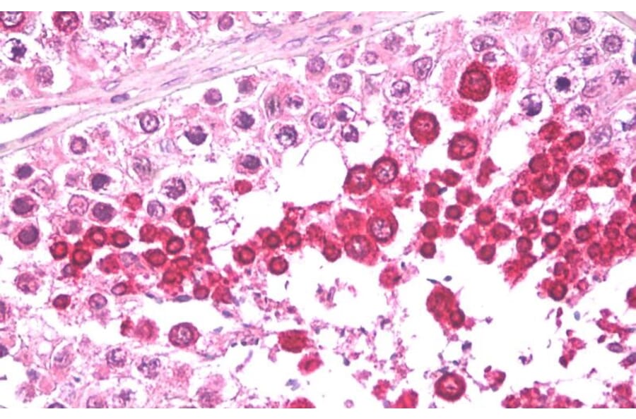 Immunohistochemistry - Anti-HIPPI/IFT57 Antibody (A84663) - Antibodies.com