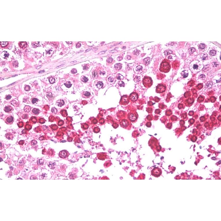 Immunohistochemistry - Anti-HIPPI/IFT57 Antibody (A84663) - Antibodies.com