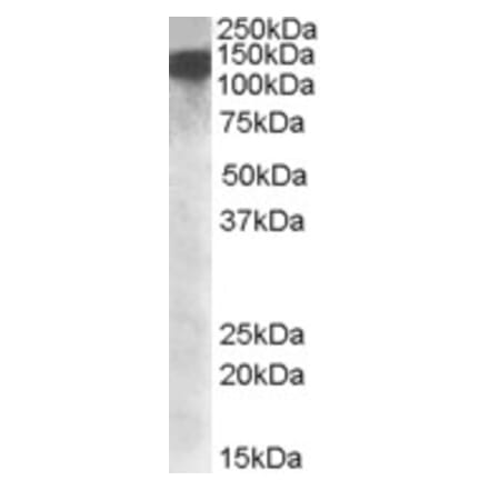 Western Blot - Anti-DHX9 Antibody (A84664) - Antibodies.com