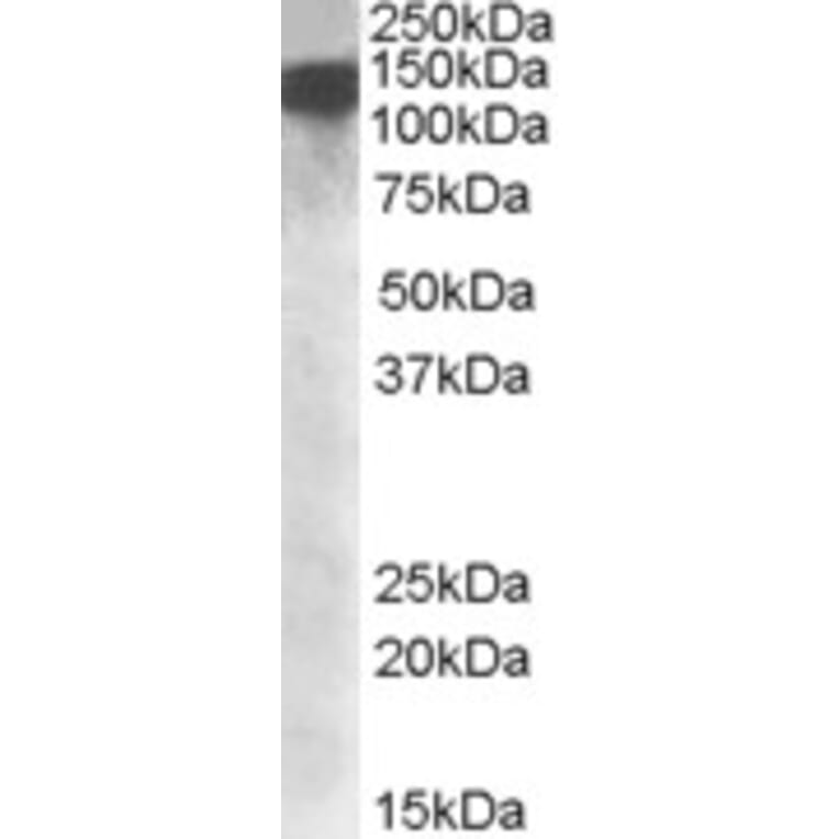 Western Blot - Anti-DHX9 Antibody (A84664) - Antibodies.com