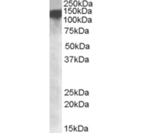 Western Blot - Anti-DHX9 Antibody (A84664) - Antibodies.com