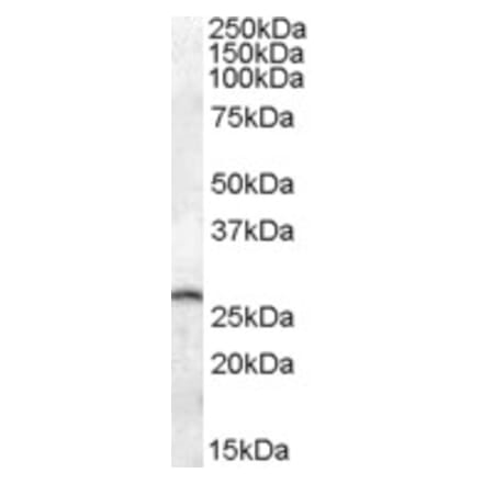 Western Blot - Anti-PSPH Antibody (A84665) - Antibodies.com