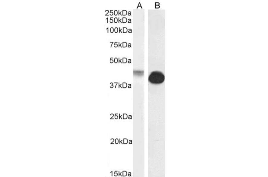 Western Blot - Anti-Connexin 43/GJA1 Antibody (A84666) - Antibodies.com