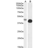Western Blot - Anti-Connexin 43/GJA1 Antibody (A84666) - Antibodies.com