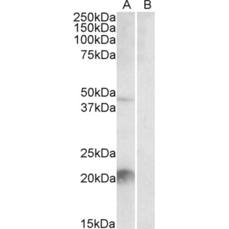 Western Blot - Anti-Klk6/Neurosin Antibody (A84667) - Antibodies.com
