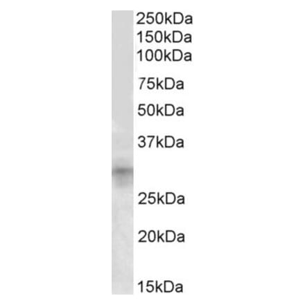 Western Blot - Anti-IGFBP7 Antibody (A84670) - Antibodies.com