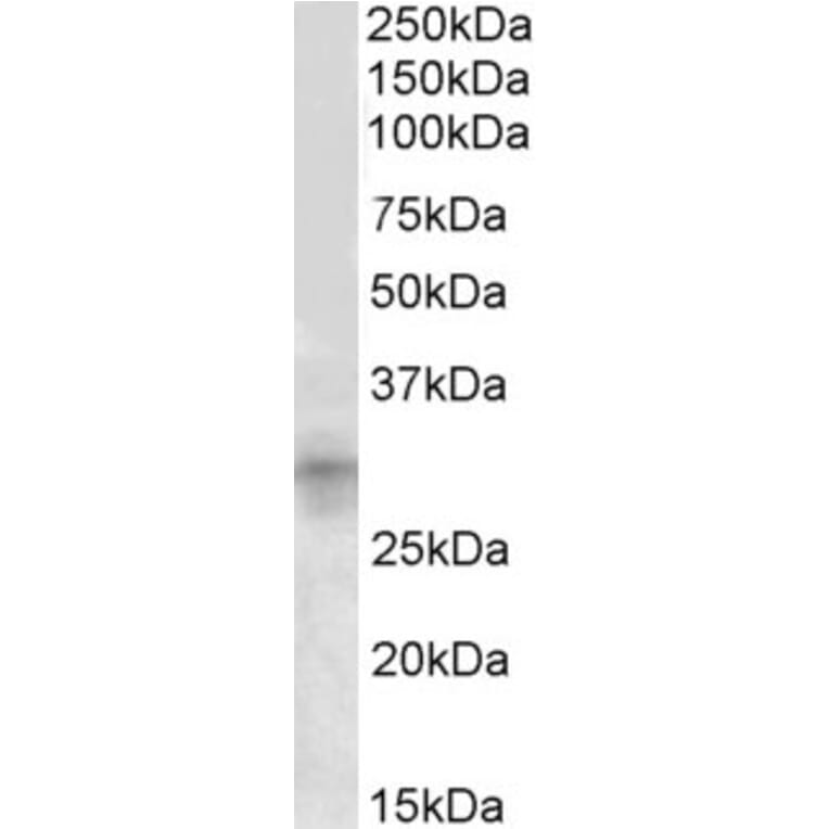Western Blot - Anti-IGFBP7 Antibody (A84670) - Antibodies.com