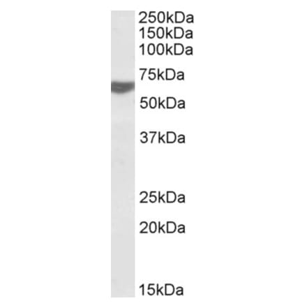 Western Blot - Anti-TERF2IP Antibody (A84675) - Antibodies.com