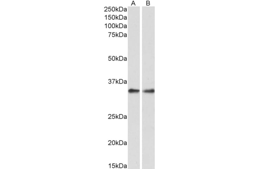 Western Blot - Anti-PP-X Antibody (A84676) - Antibodies.com