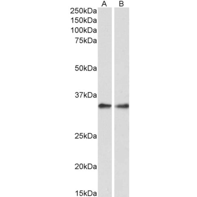 Western Blot - Anti-PP-X Antibody (A84676) - Antibodies.com