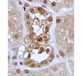 Immunohistochemistry - Anti-SGK1 Antibody (A84677) - Antibodies.com