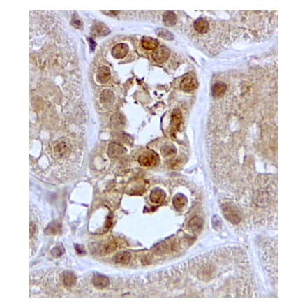Immunohistochemistry - Anti-SGK1 Antibody (A84677) - Antibodies.com