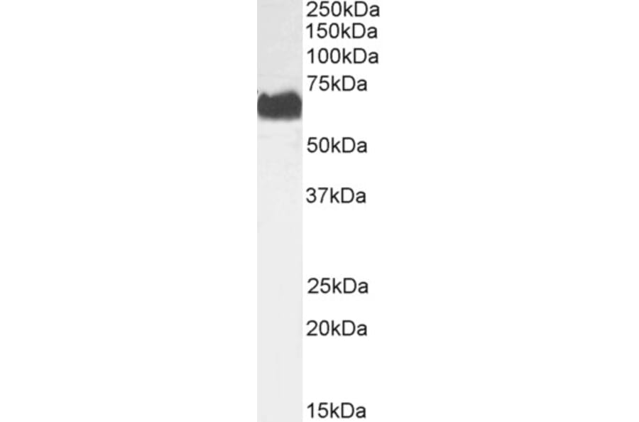 Western Blot - Anti-SPAK Antibody (A84678) - Antibodies.com