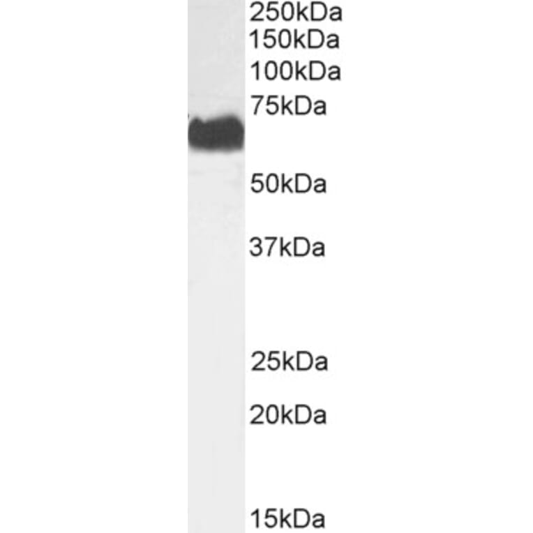 Western Blot - Anti-SPAK Antibody (A84678) - Antibodies.com