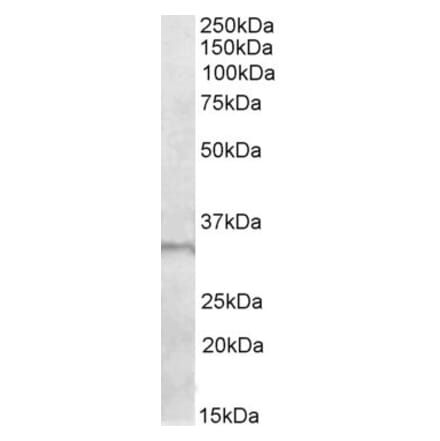 Western Blot - Anti-E2F6 Antibody (A84680) - Antibodies.com