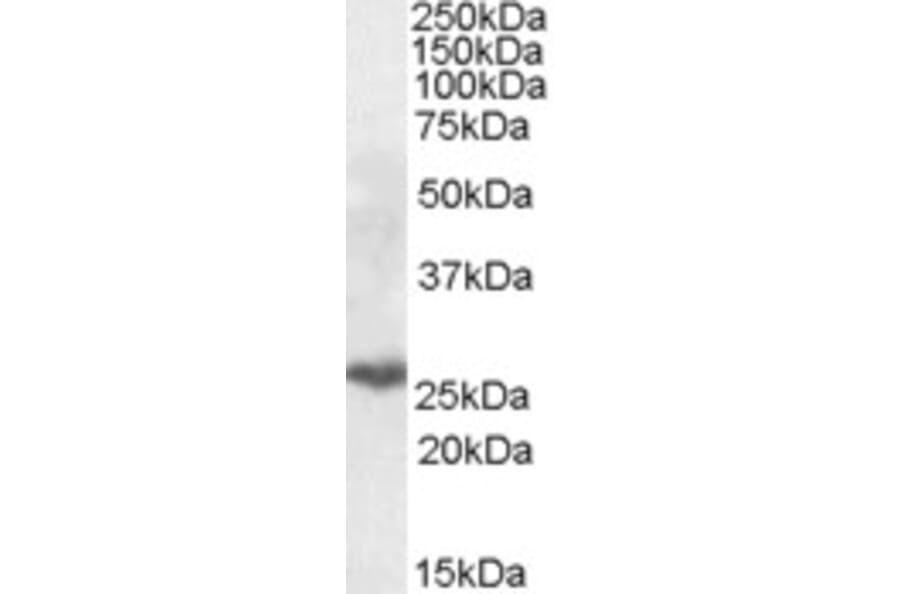 Western Blot - Anti-PSMB10/MECL1 Antibody (A84682) - Antibodies.com