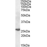 Western Blot - Anti-PSMB10/MECL1 Antibody (A84682) - Antibodies.com