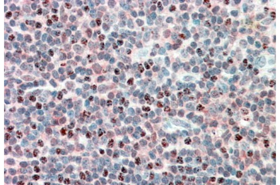 Immunohistochemistry - Anti-PSMB10/MECL1 Antibody (A84682) - Antibodies.com