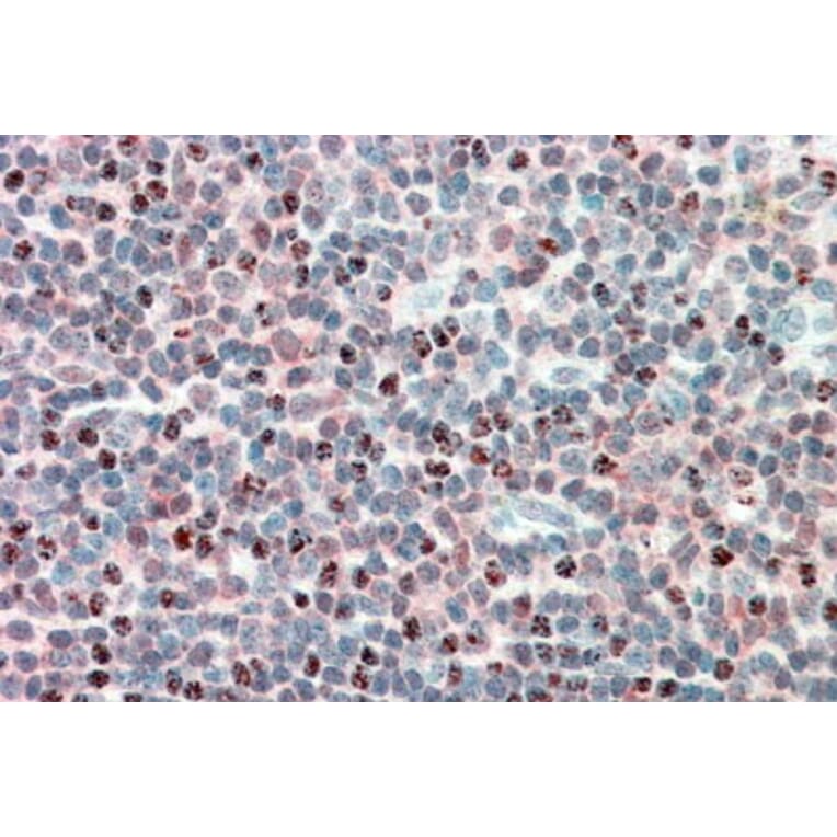 Immunohistochemistry - Anti-PSMB10/MECL1 Antibody (A84682) - Antibodies.com