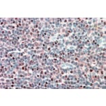 Immunohistochemistry - Anti-PSMB10/MECL1 Antibody (A84682) - Antibodies.com
