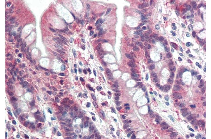 Immunohistochemistry - Anti-PSMB10/MECL1 Antibody (A84682) - Antibodies.com