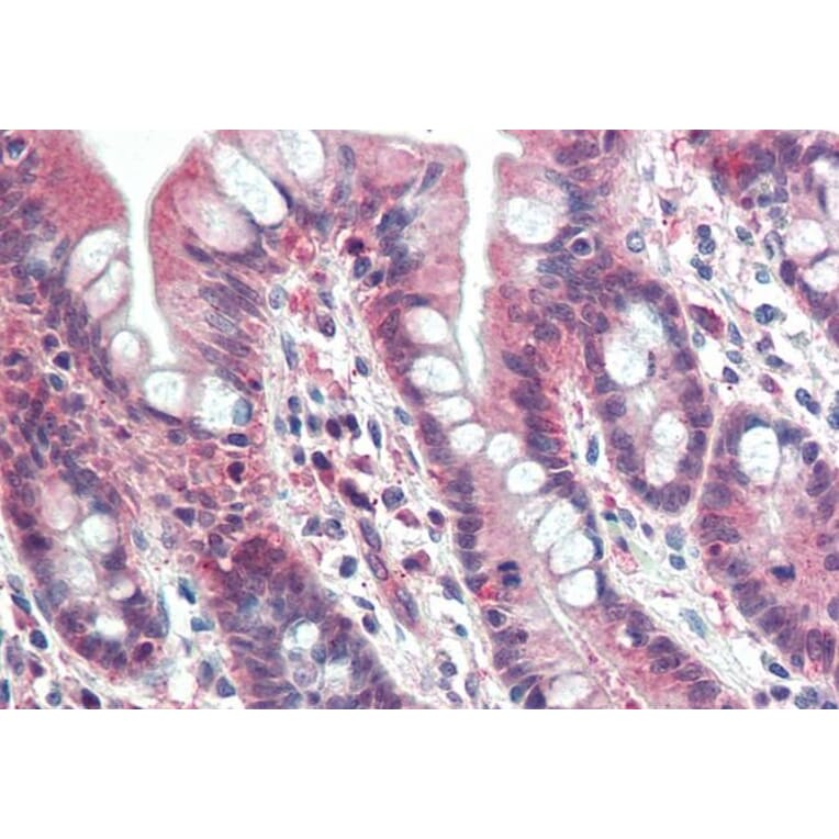 Immunohistochemistry - Anti-PSMB10/MECL1 Antibody (A84682) - Antibodies.com