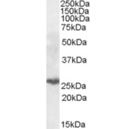 Western Blot - Anti-PSMB10 Antibody (A84682) - Antibodies.com
