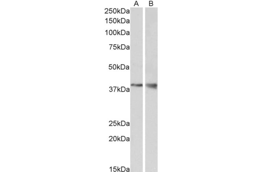 Western Blot - Anti-Wnt9b Antibody (A84683) - Antibodies.com