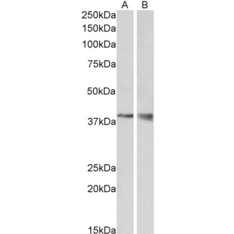Western Blot - Anti-Wnt9b Antibody (A84683) - Antibodies.com