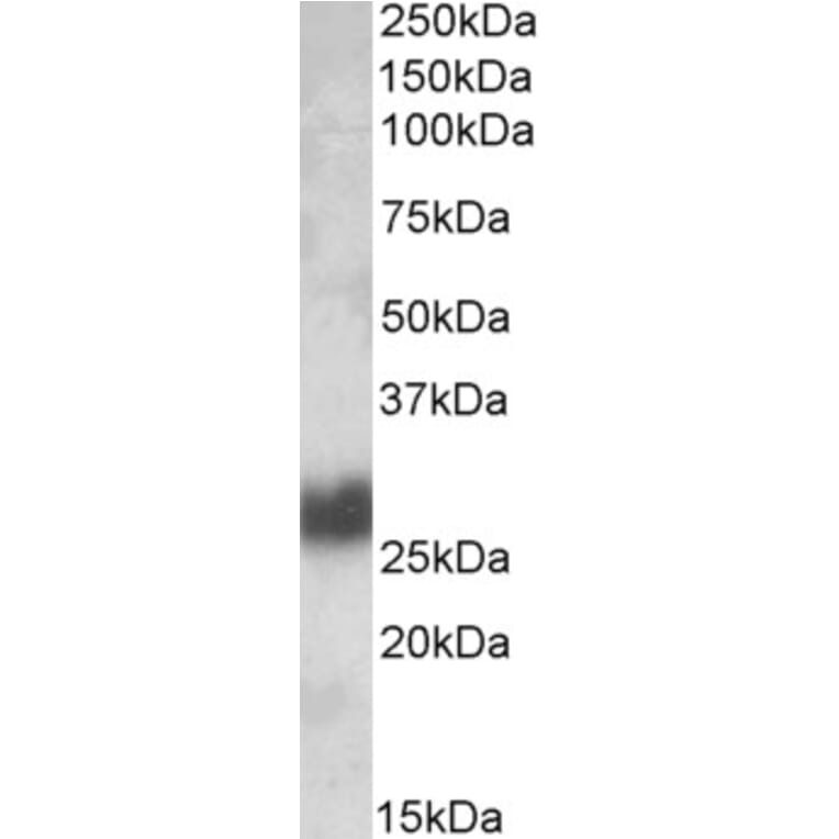 Western Blot - Anti-CD90/Thy1 Antibody (A84684) - Antibodies.com