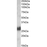 Western Blot - Anti-CD90/Thy1 Antibody (A84684) - Antibodies.com