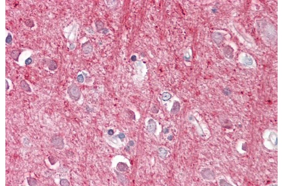Immunohistochemistry - Anti-CD90/Thy1 Antibody (A84684) - Antibodies.com