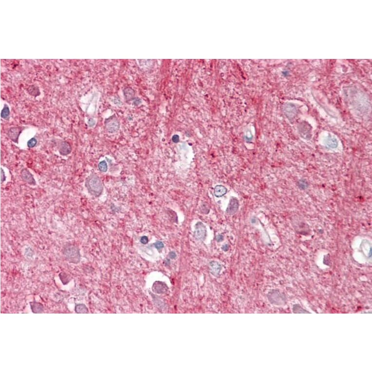 Immunohistochemistry - Anti-CD90/Thy1 Antibody (A84684) - Antibodies.com