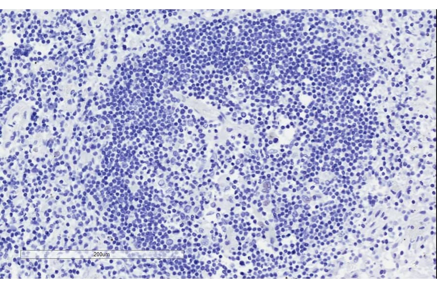 Immunohistochemistry - Anti-ICOS Antibody (A84686) - Antibodies.com