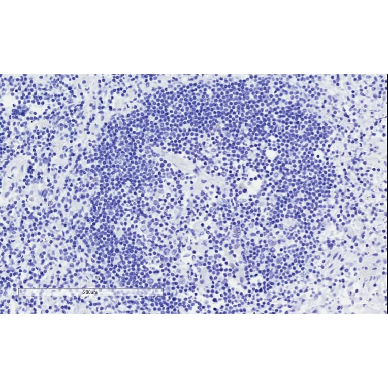 Immunohistochemistry - Anti-ICOS Antibody (A84686) - Antibodies.com