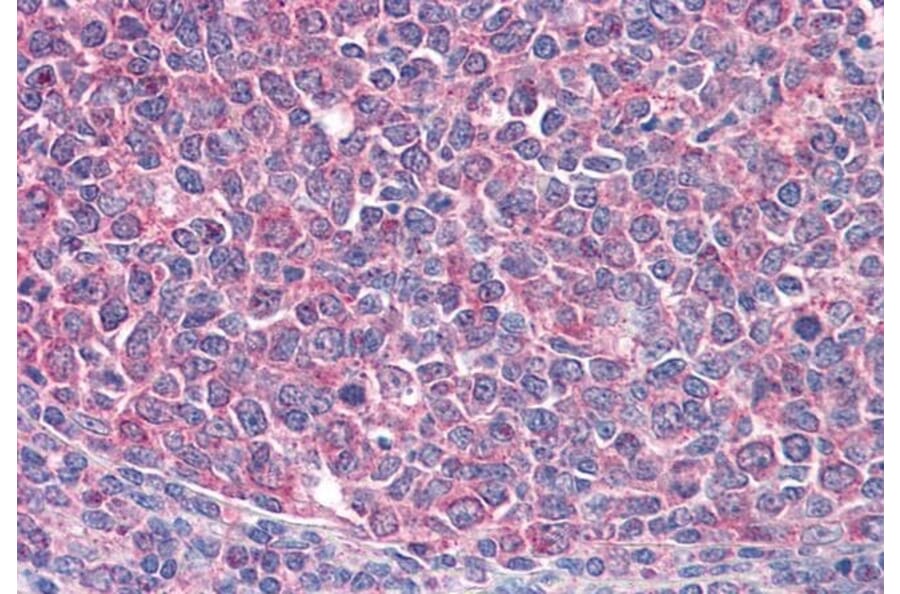 Immunohistochemistry - Anti-ICOS Antibody (A84686) - Antibodies.com