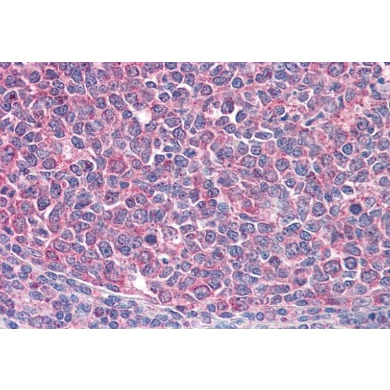 Immunohistochemistry - Anti-ICOS Antibody (A84686) - Antibodies.com