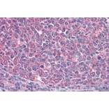 Immunohistochemistry - Anti-ICOS Antibody (A84686) - Antibodies.com