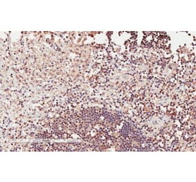 Immunohistochemistry - Anti-ICOS Antibody (A84686) - Antibodies.com
