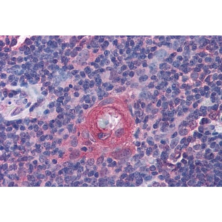 Immunohistochemistry - Anti-ICOS Antibody (A84686) - Antibodies.com