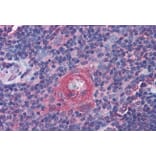 Immunohistochemistry - Anti-ICOS Antibody (A84686) - Antibodies.com