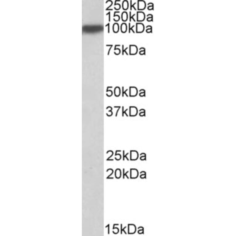 Western Blot - Anti-Aconitase 1/ACO1 Antibody (A84687) - Antibodies.com