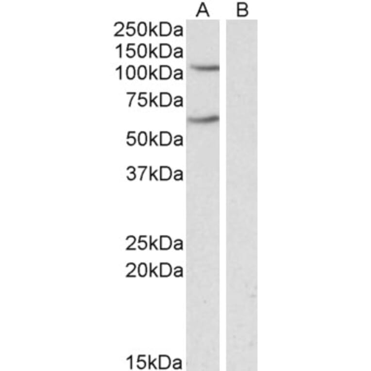 Western Blot - Anti-IREB2/IRP2 Antibody (A84688) - Antibodies.com