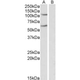 Western Blot - Anti-IREB2/IRP2 Antibody (A84688) - Antibodies.com