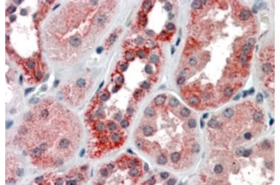 Immunohistochemistry - Anti-IREB2/IRP2 Antibody (A84688) - Antibodies.com
