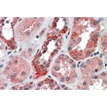 Immunohistochemistry - Anti-IREB2/IRP2 Antibody (A84688) - Antibodies.com