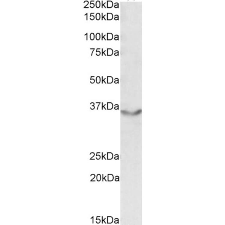 Western Blot - Anti-Junctional Adhesion Molecule 2/JAM-B Antibody (A84690) - Antibodies.com